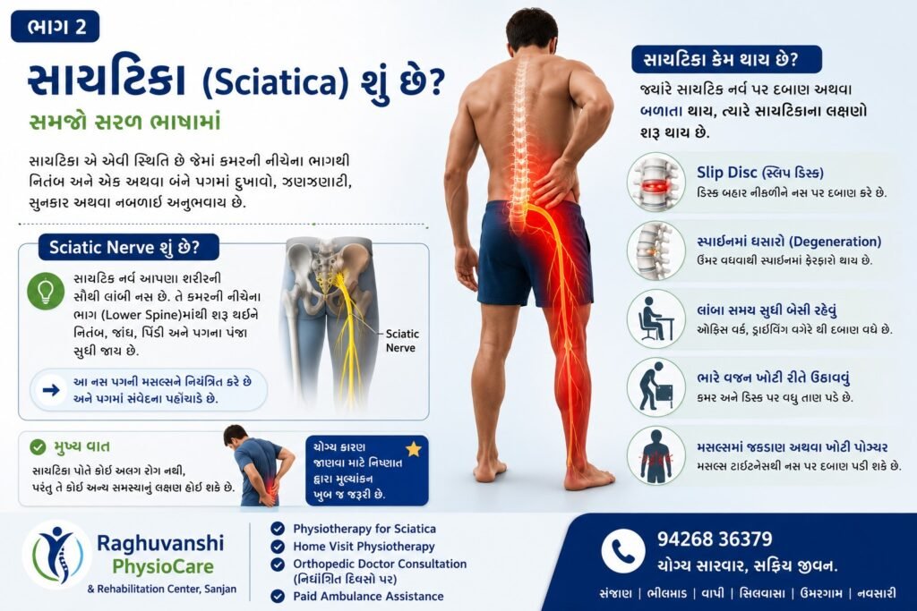 સાયટિકા (Sciatica) શું છે?